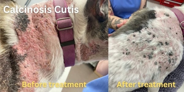 before and after calcinosis cutis treatment
